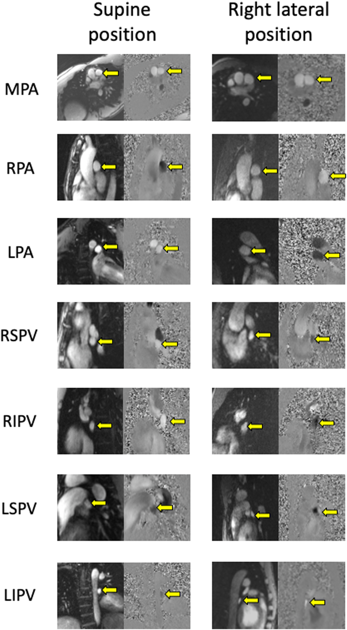 Fig. 13