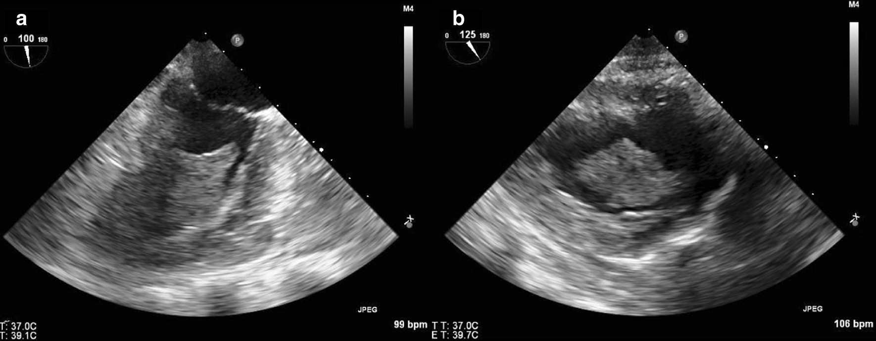 Fig. 12