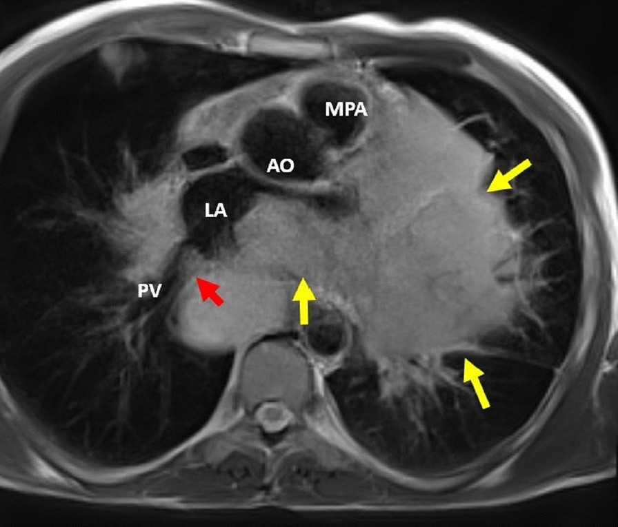 Fig. 16