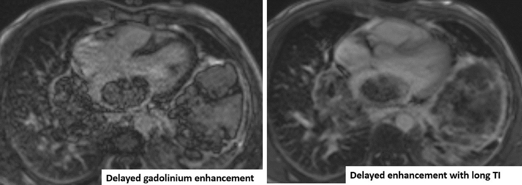 Fig. 18