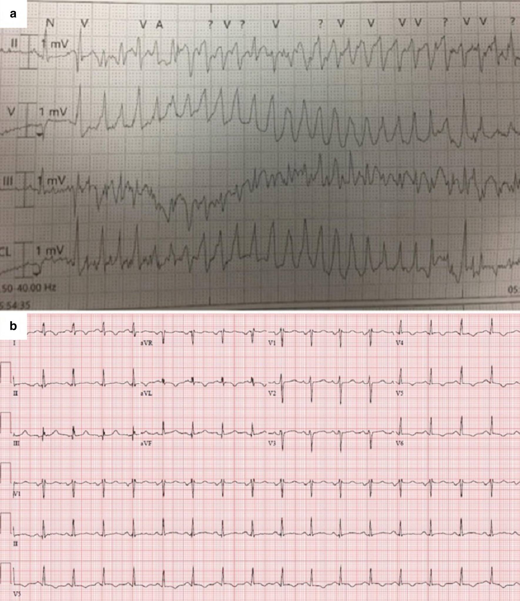 Fig. 22