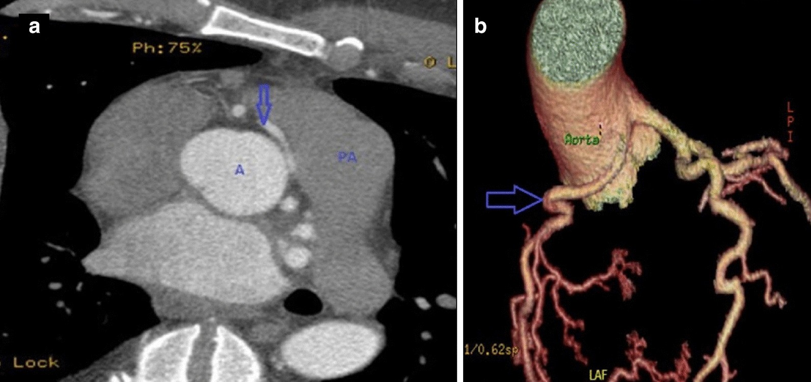 Fig. 23