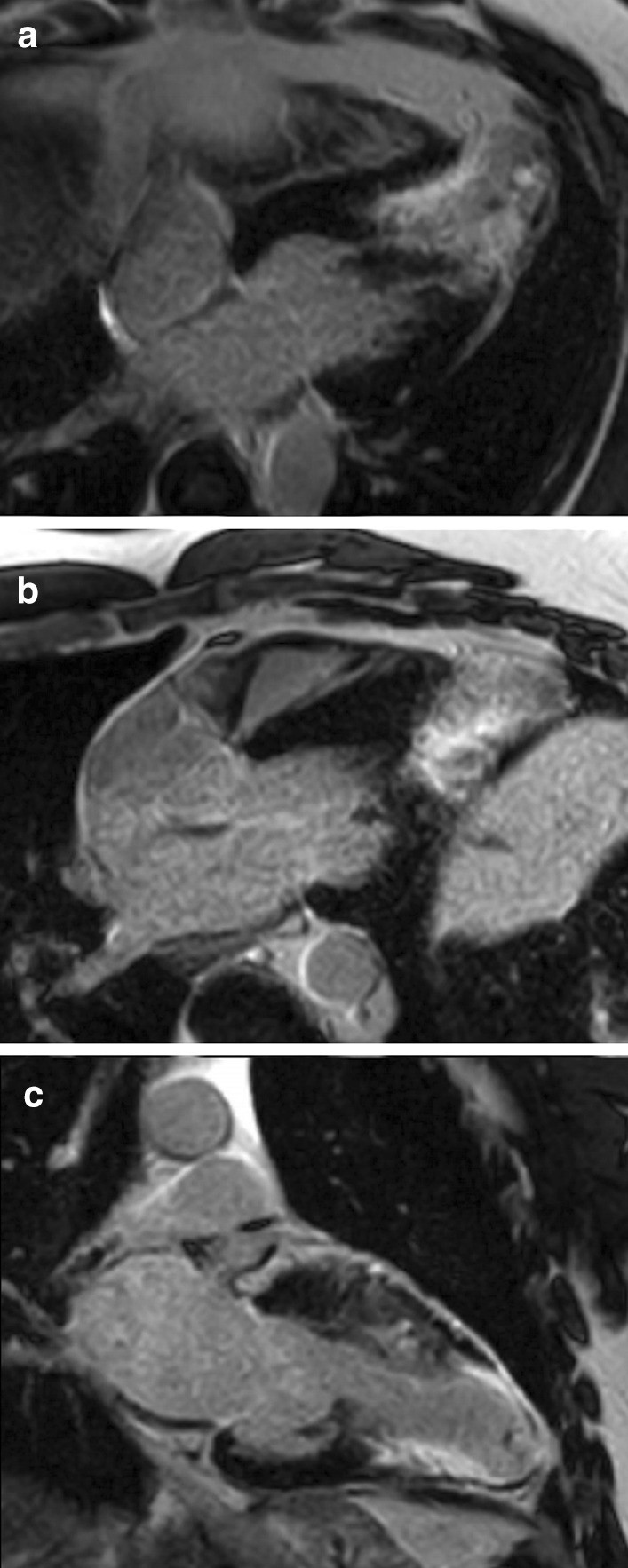 Fig. 25