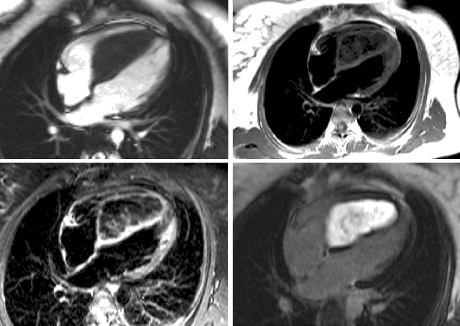 Fig. 13