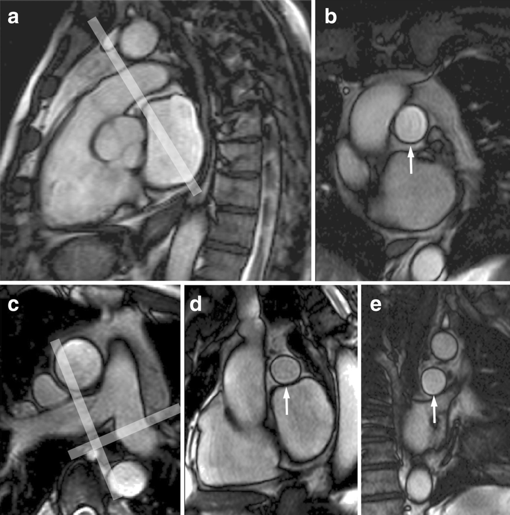 Fig. 13