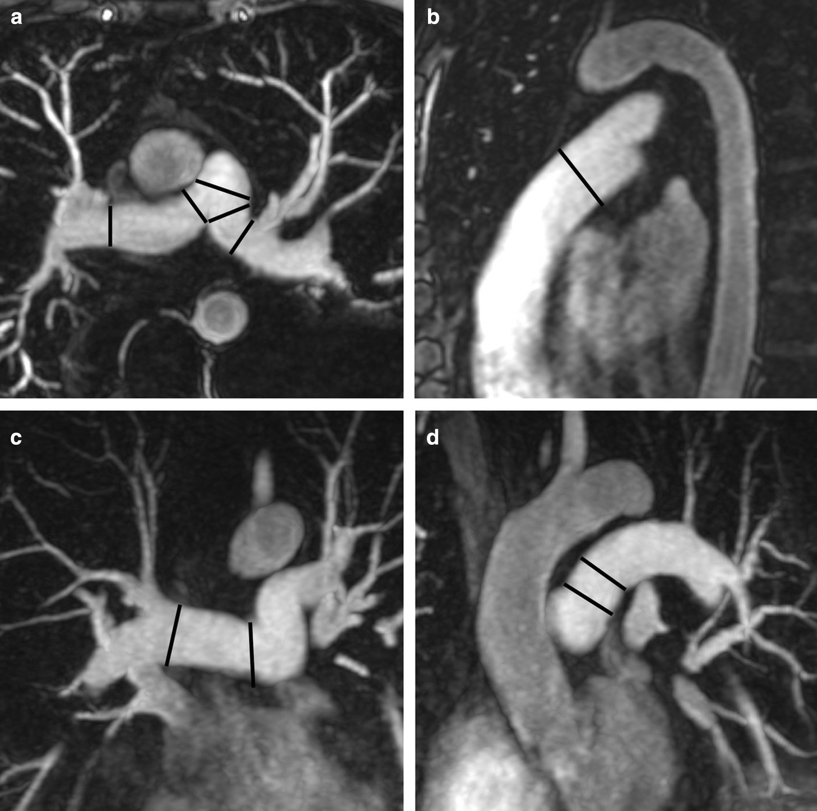 Fig. 14