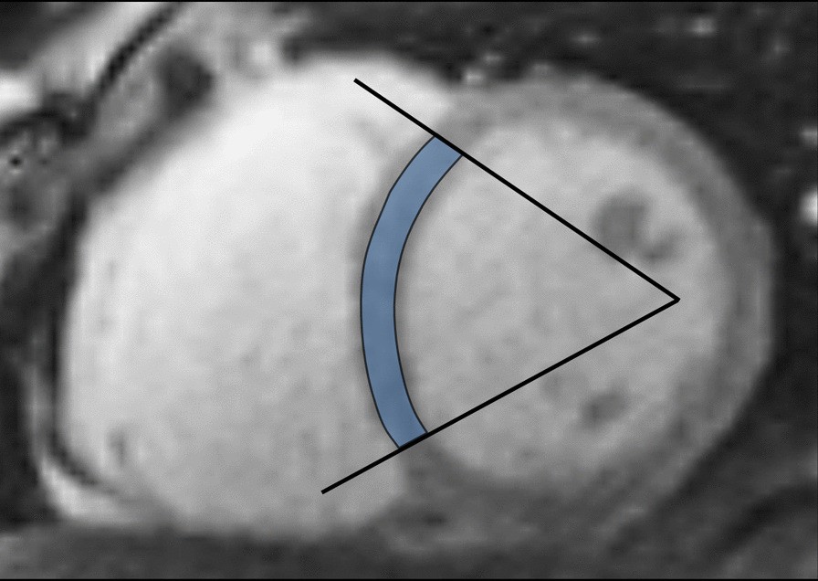 Fig. 16