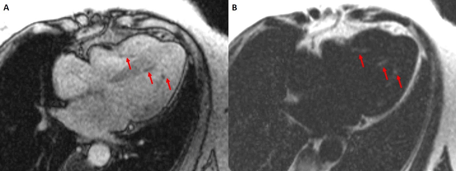 Fig. 11