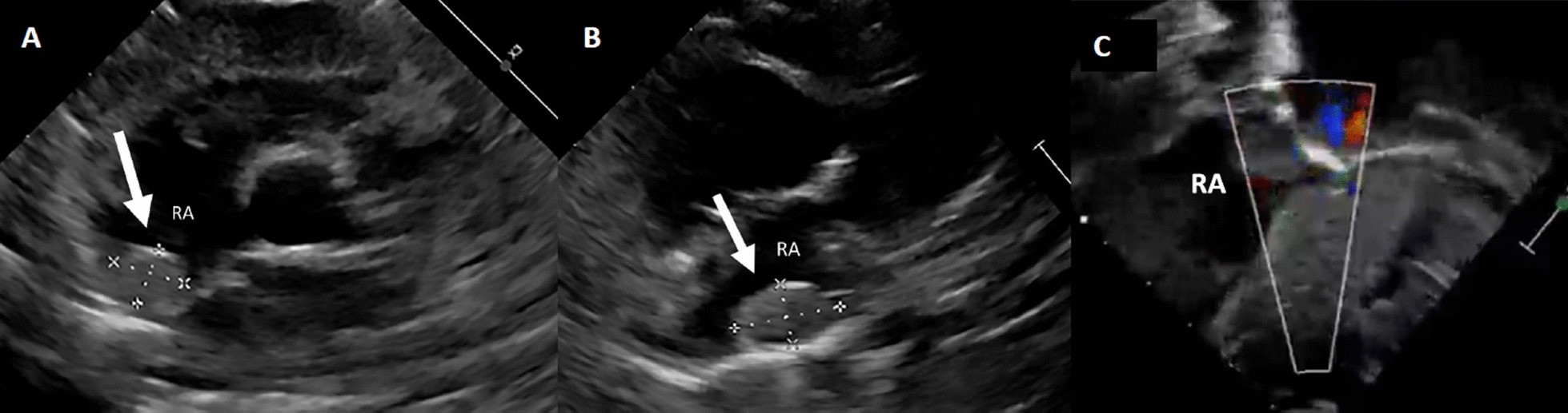 Fig. 36