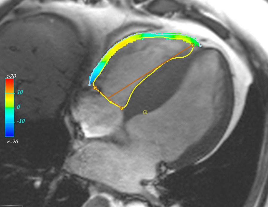 Fig. 2