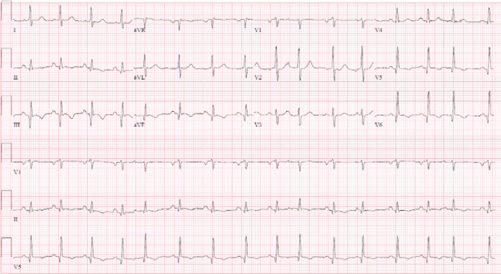 Fig. 14