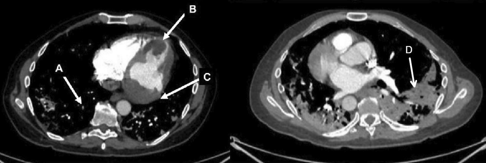 Fig. 30