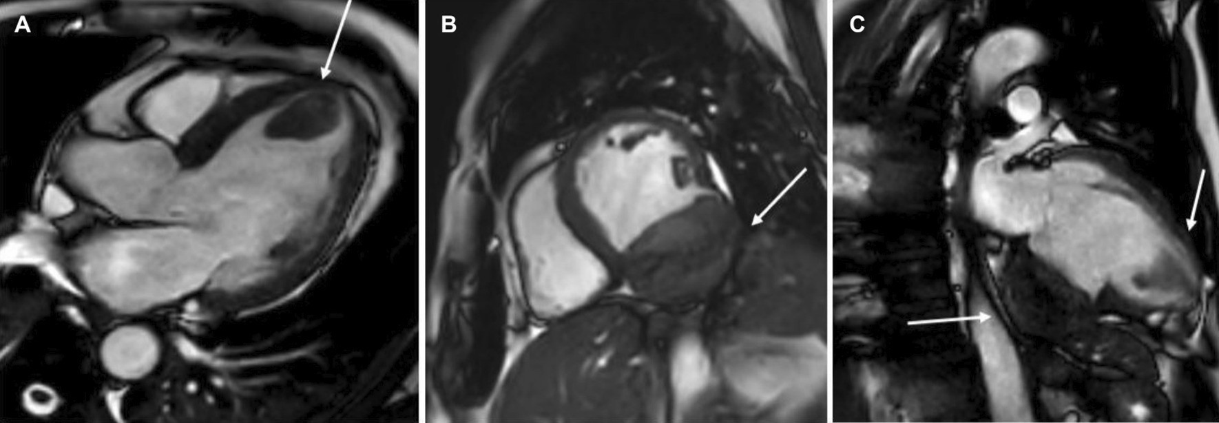 Fig. 32