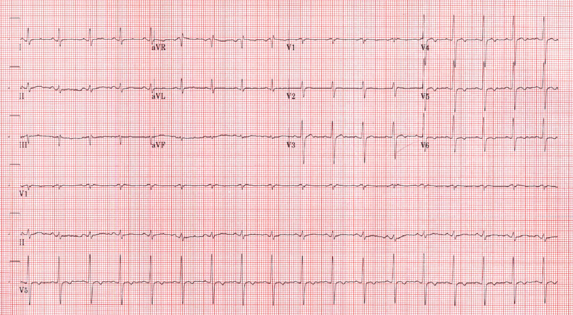 Fig. 36