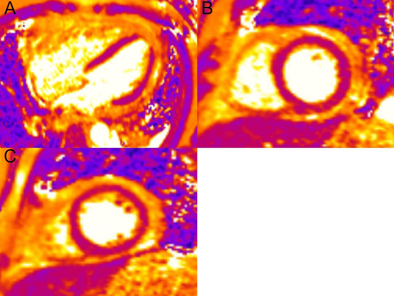 Fig. 37