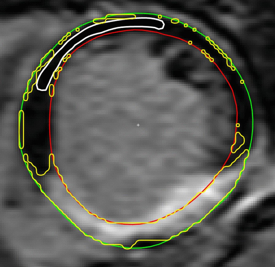 Fig. 3