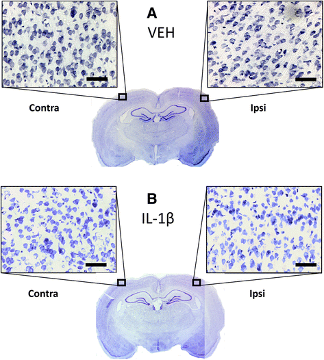 Fig. 10