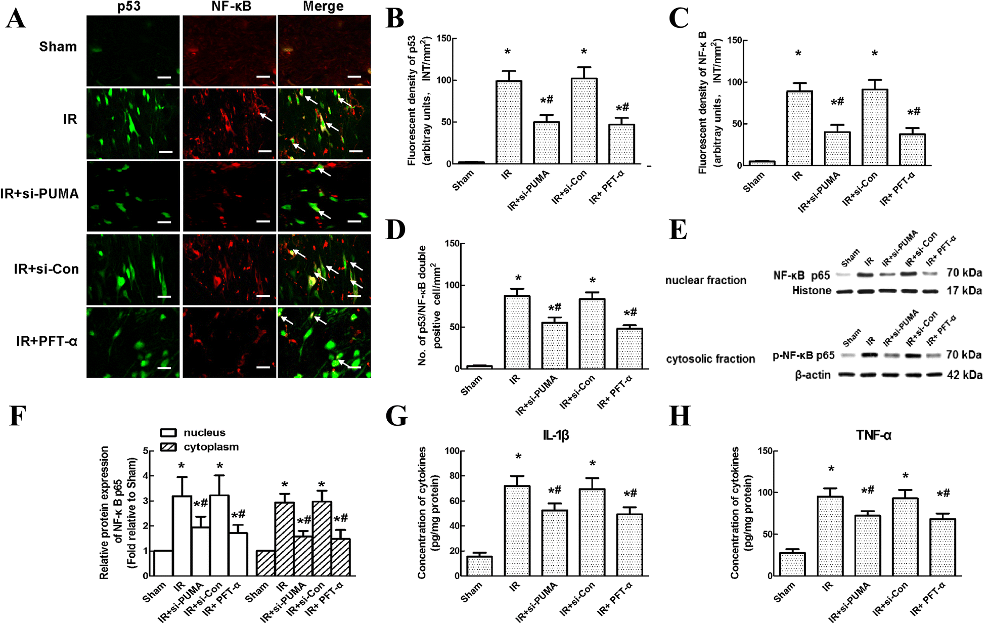 Inhibiting aberrant p53-PUMA feedback loop activation attenuates ischaemia  reperfusion-induced neuroapoptosis and neuroinflammation in rats by  downregulating caspase 3 and the NF-κB cytokine pathway | Journal of  Neuroinflammation | Full Text