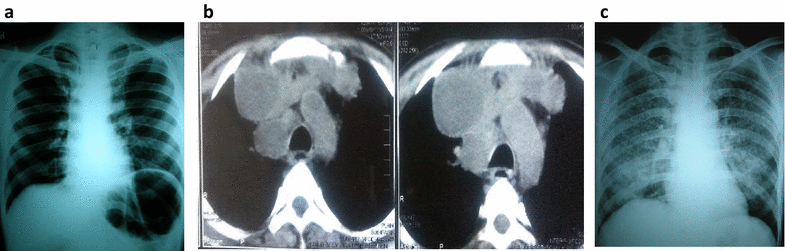 Fig. 1