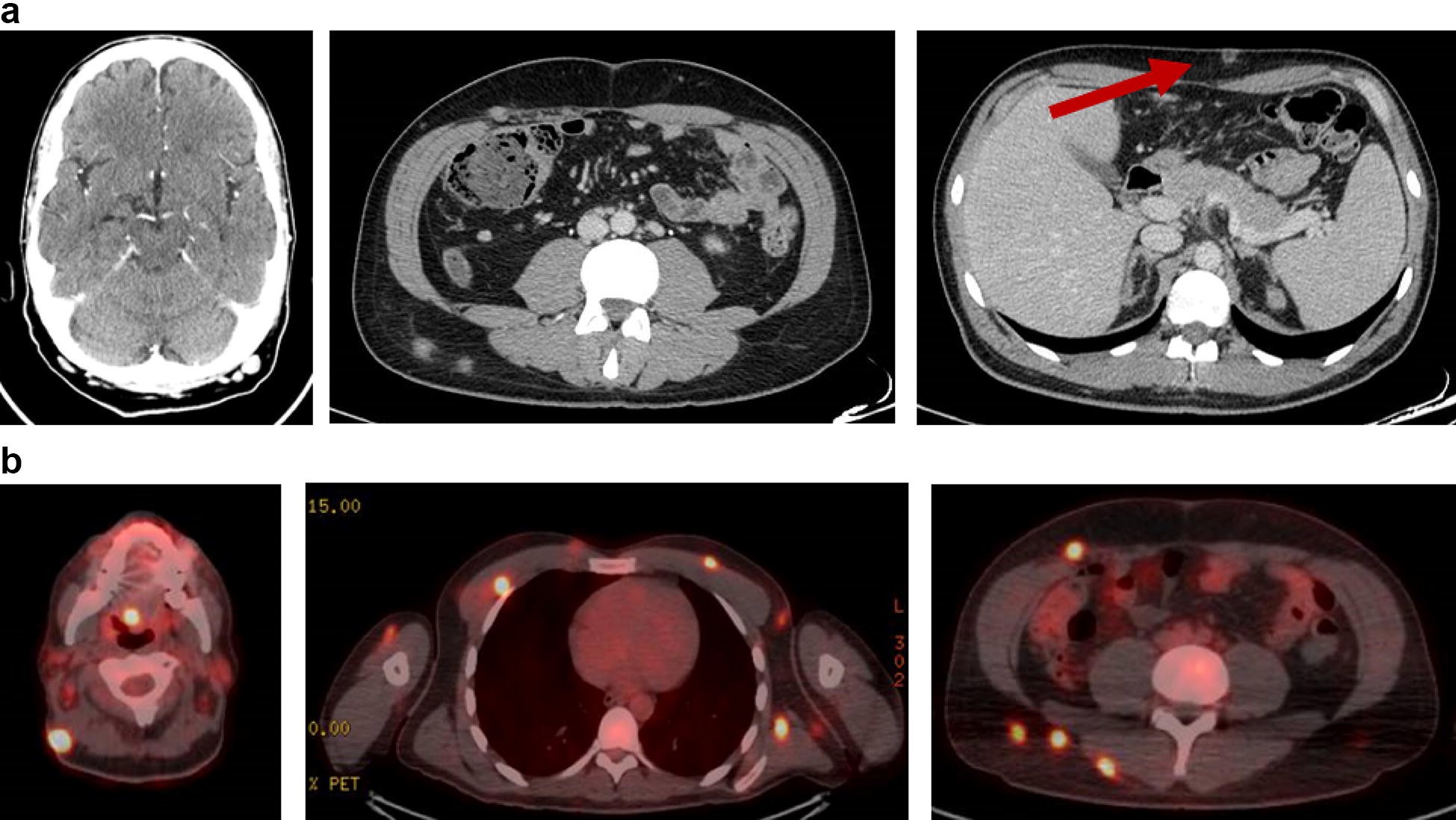 Fig. 1