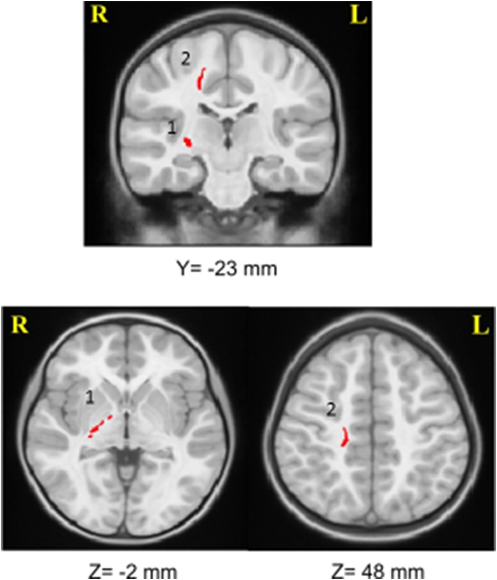 Fig. 1