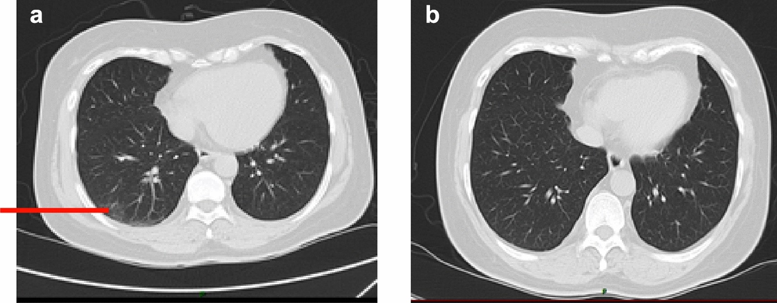 Fig. 3