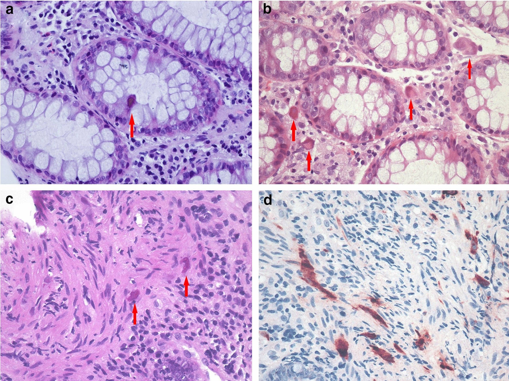 Fig. 1