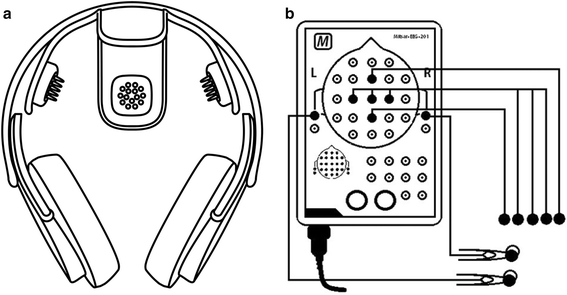 Fig. 1