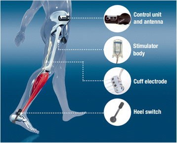 Functional Electrical Stimulation