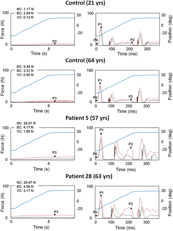 Fig. 2