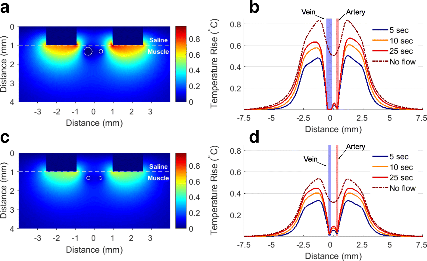 Mechanisms Of Electrical Vasoconstriction Journal Of Neuroengineering And Rehabilitation Full Text