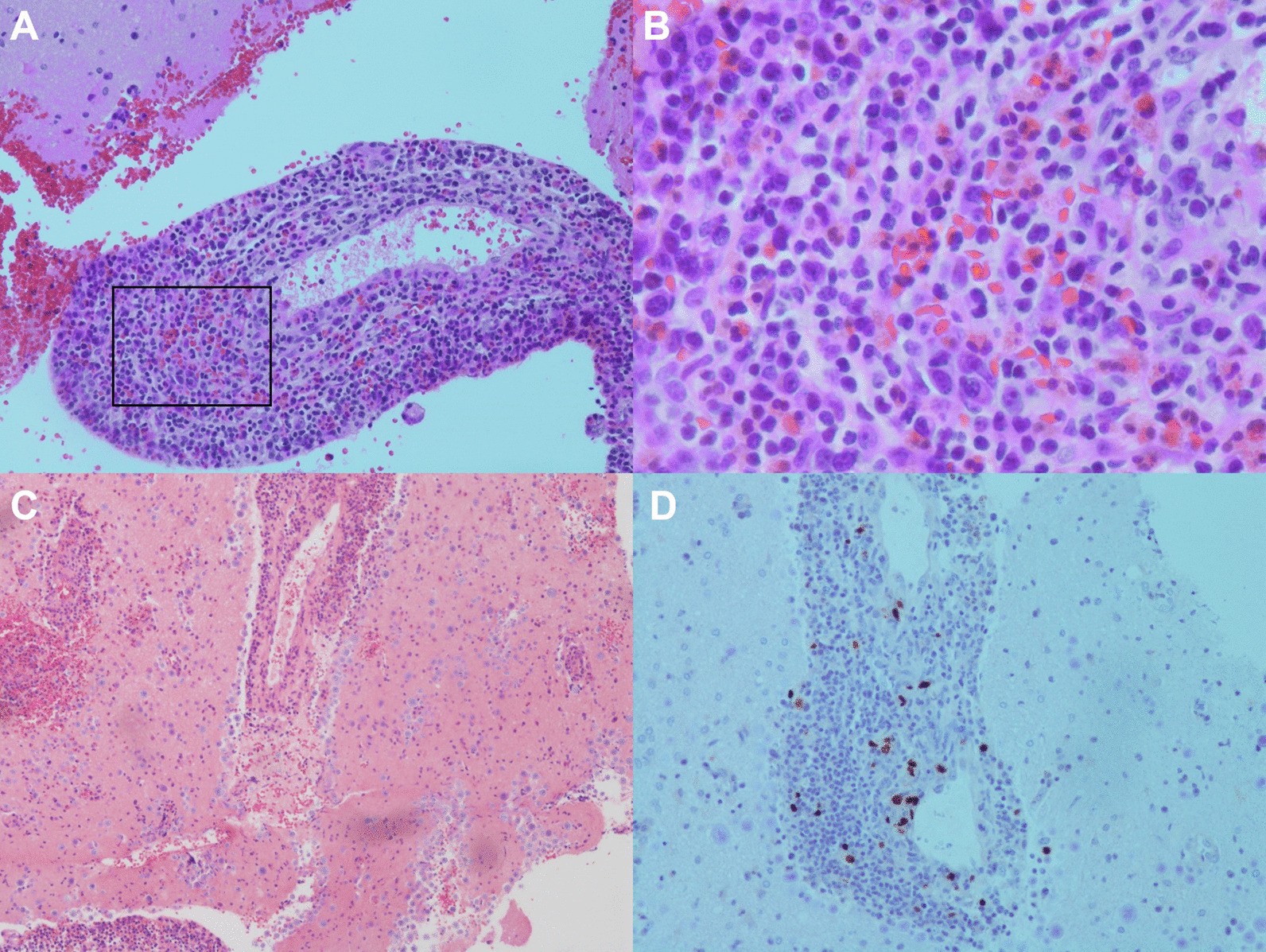 Fig. 2