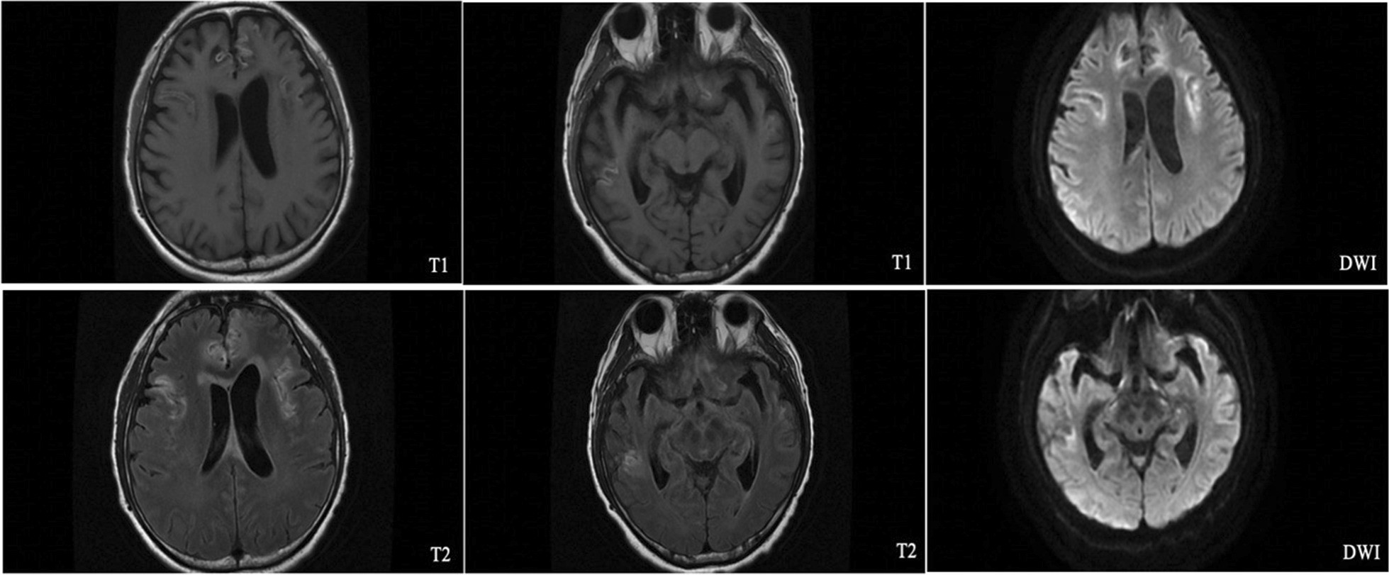 Fig. 2