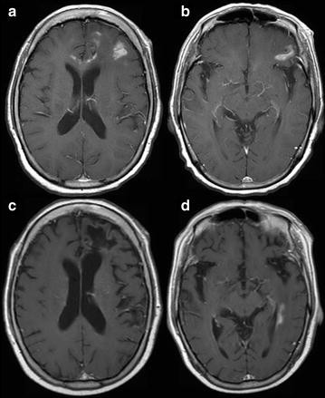 Fig. 1