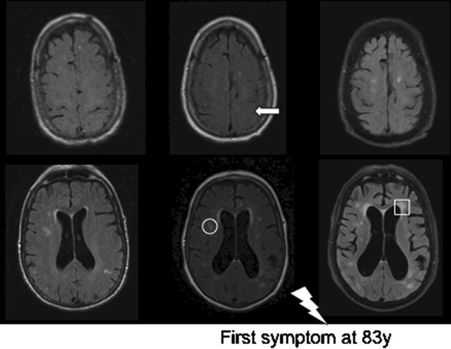 Fig. 1