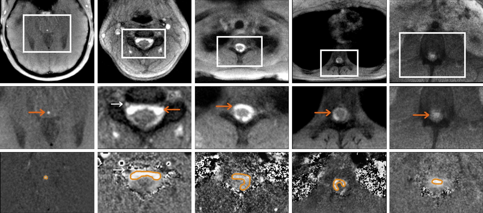 Fig. 1