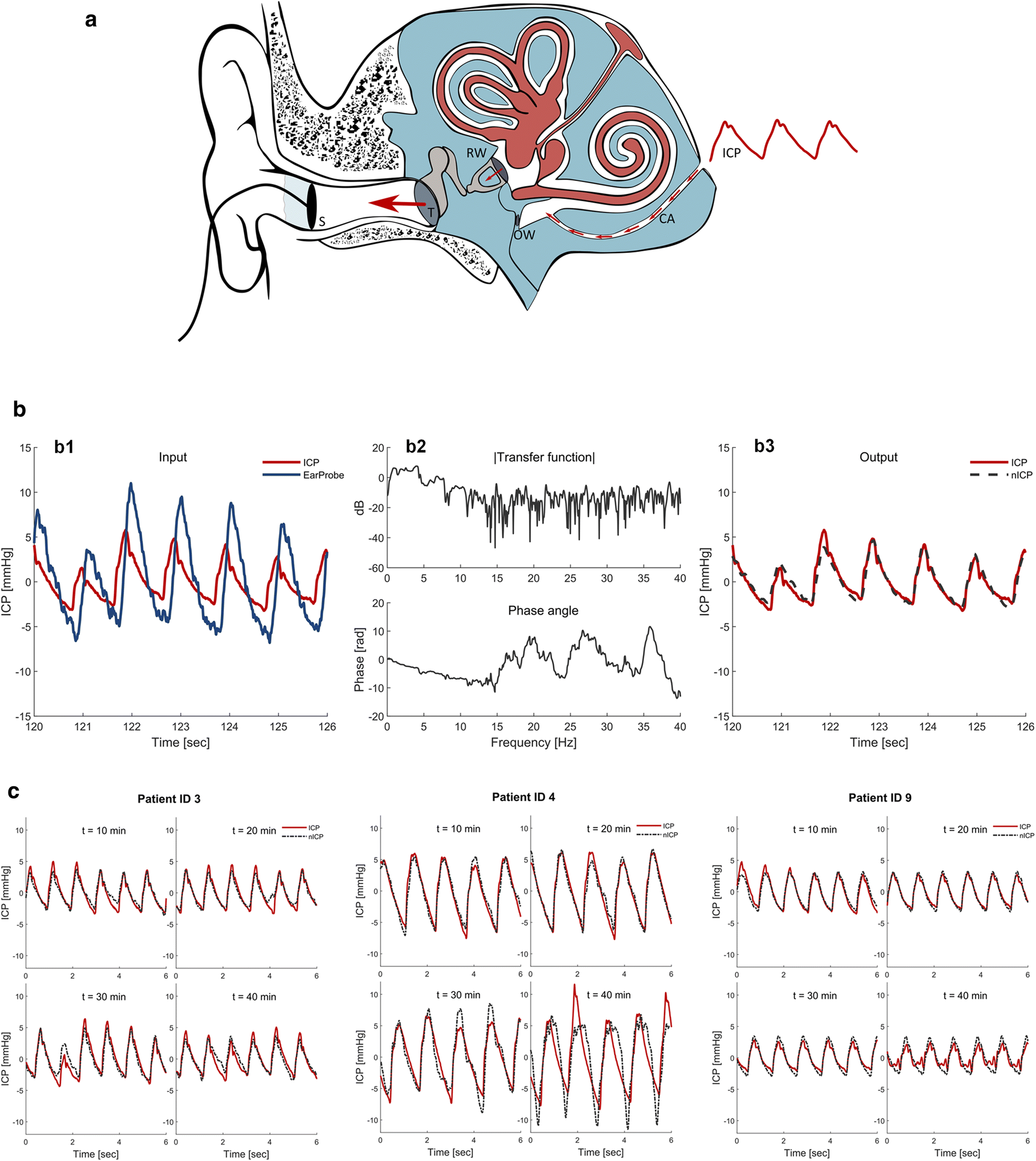 Fig. 11