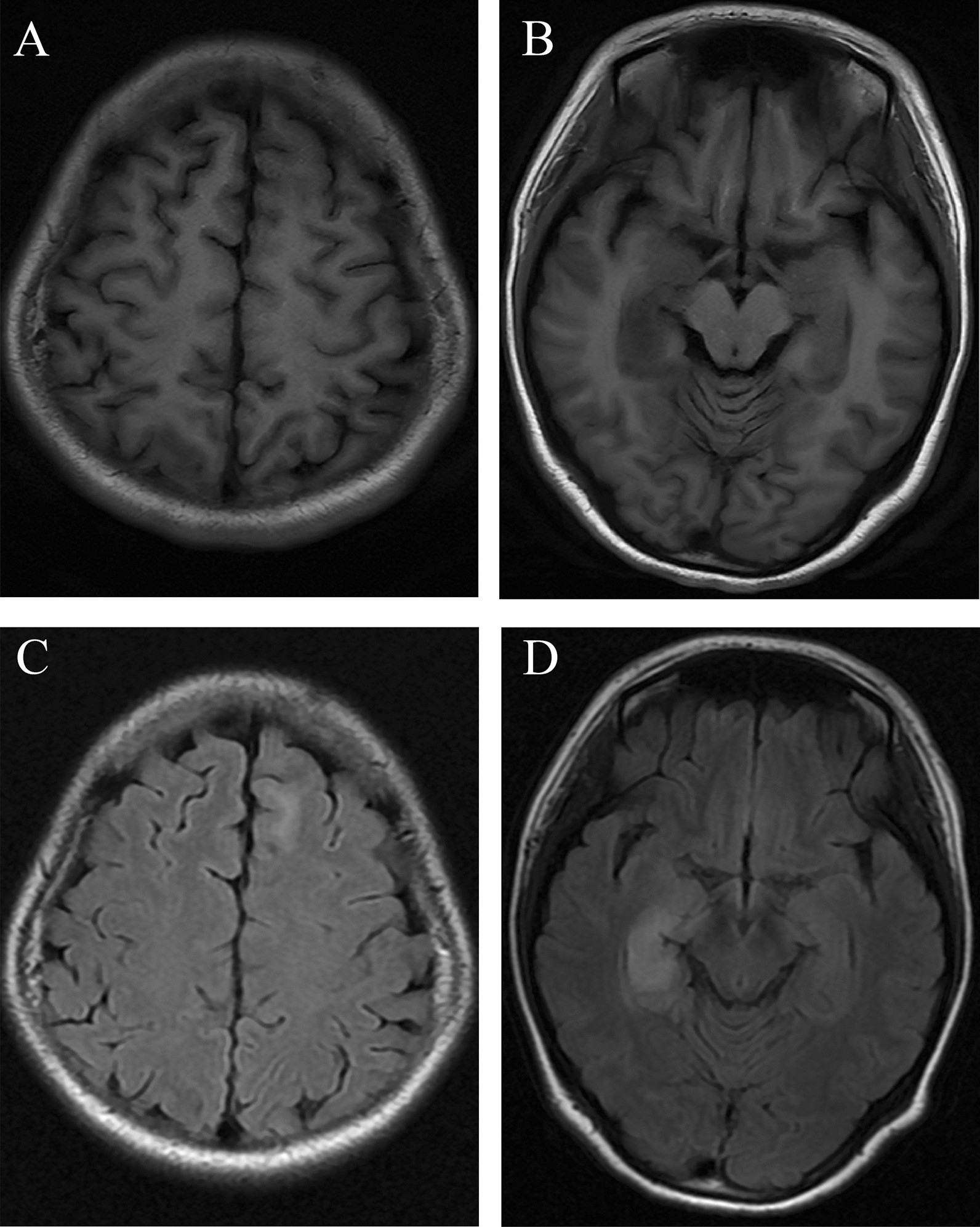 Fig. 1