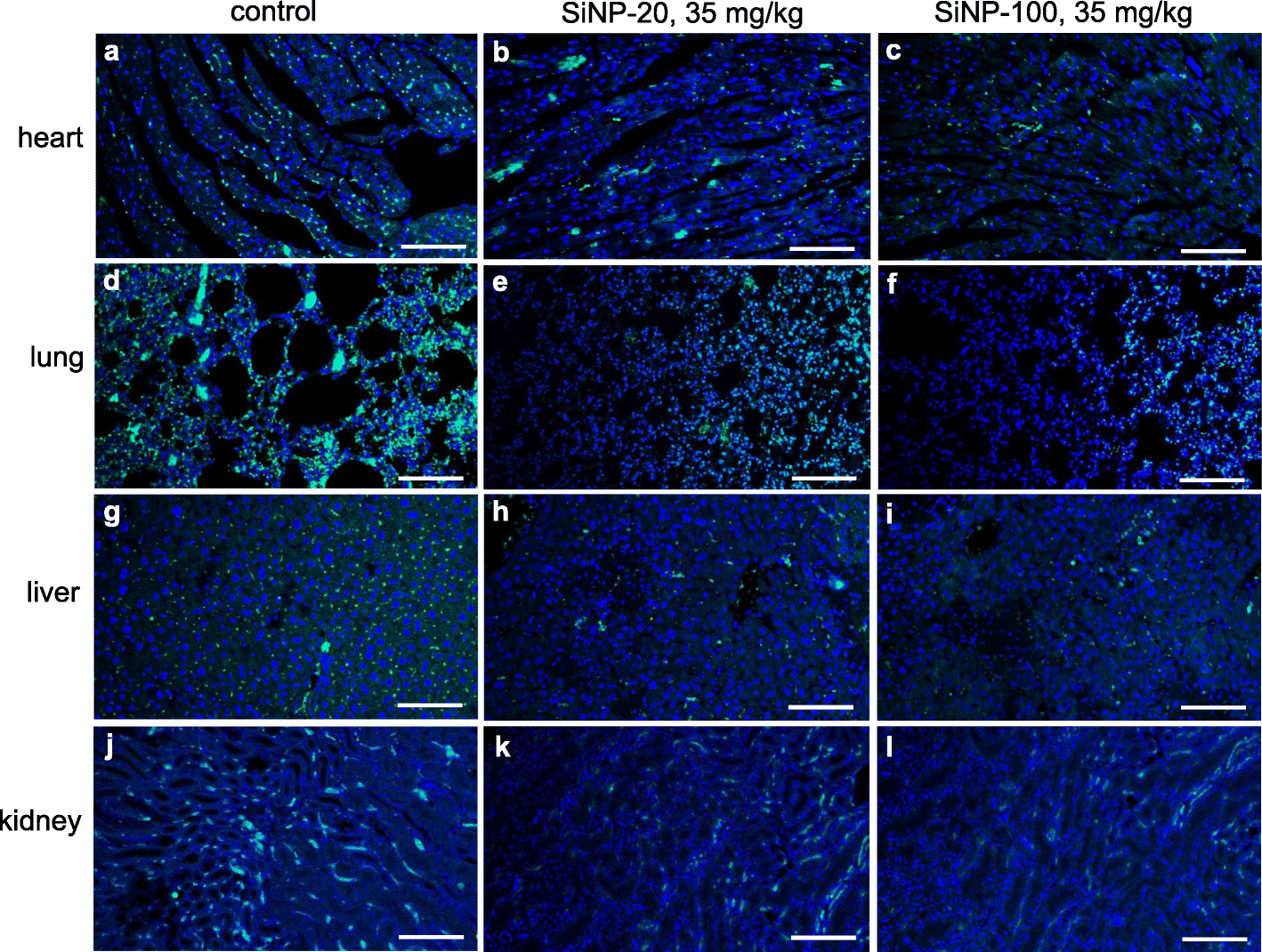 Fig. 11