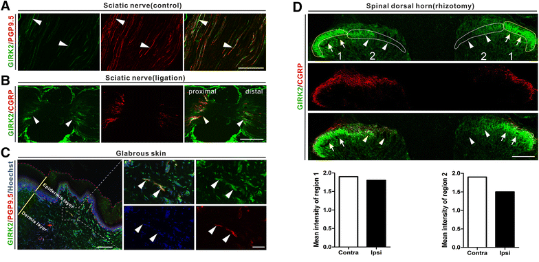 Figure 11