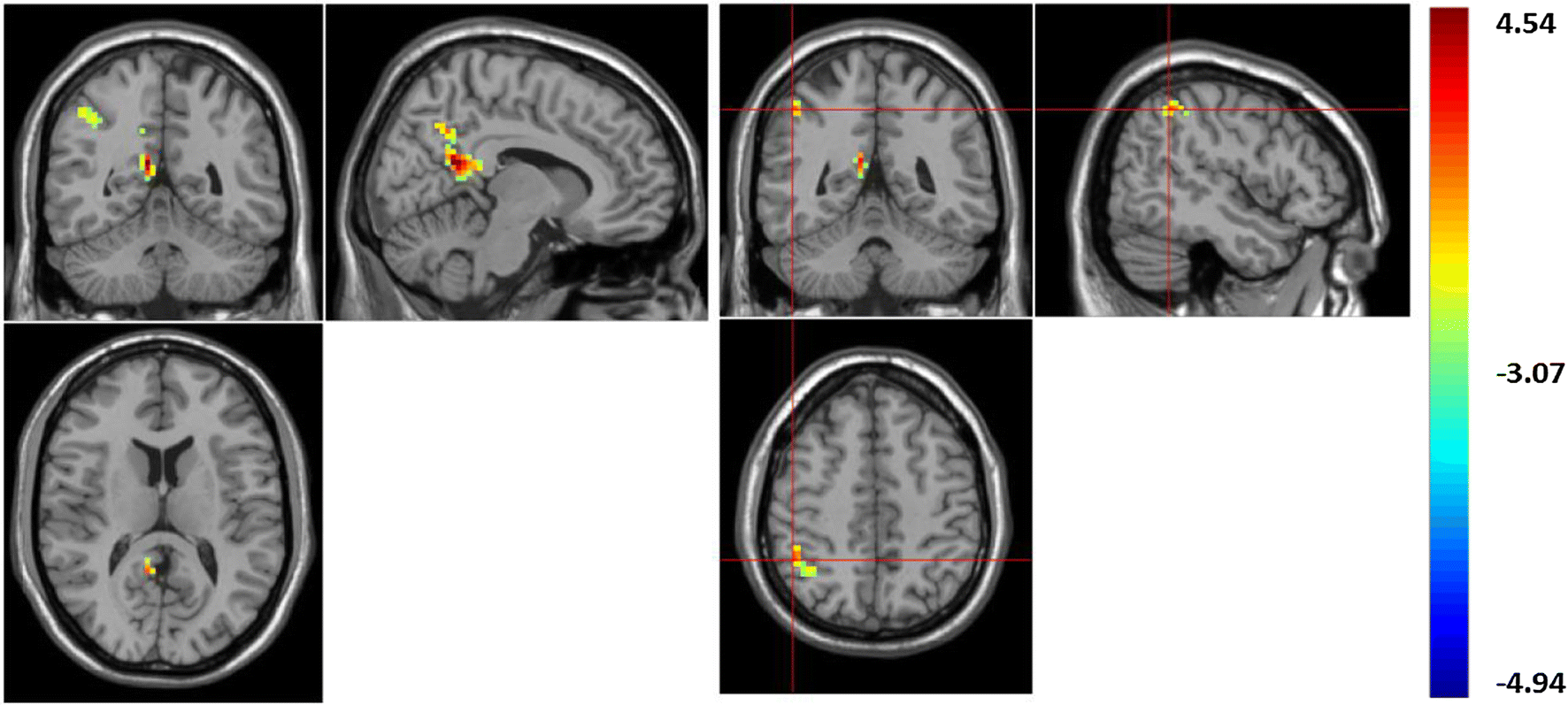 Fig. 1