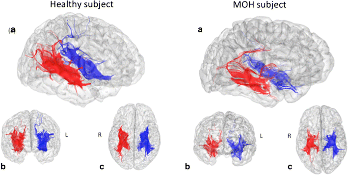 Fig. 2