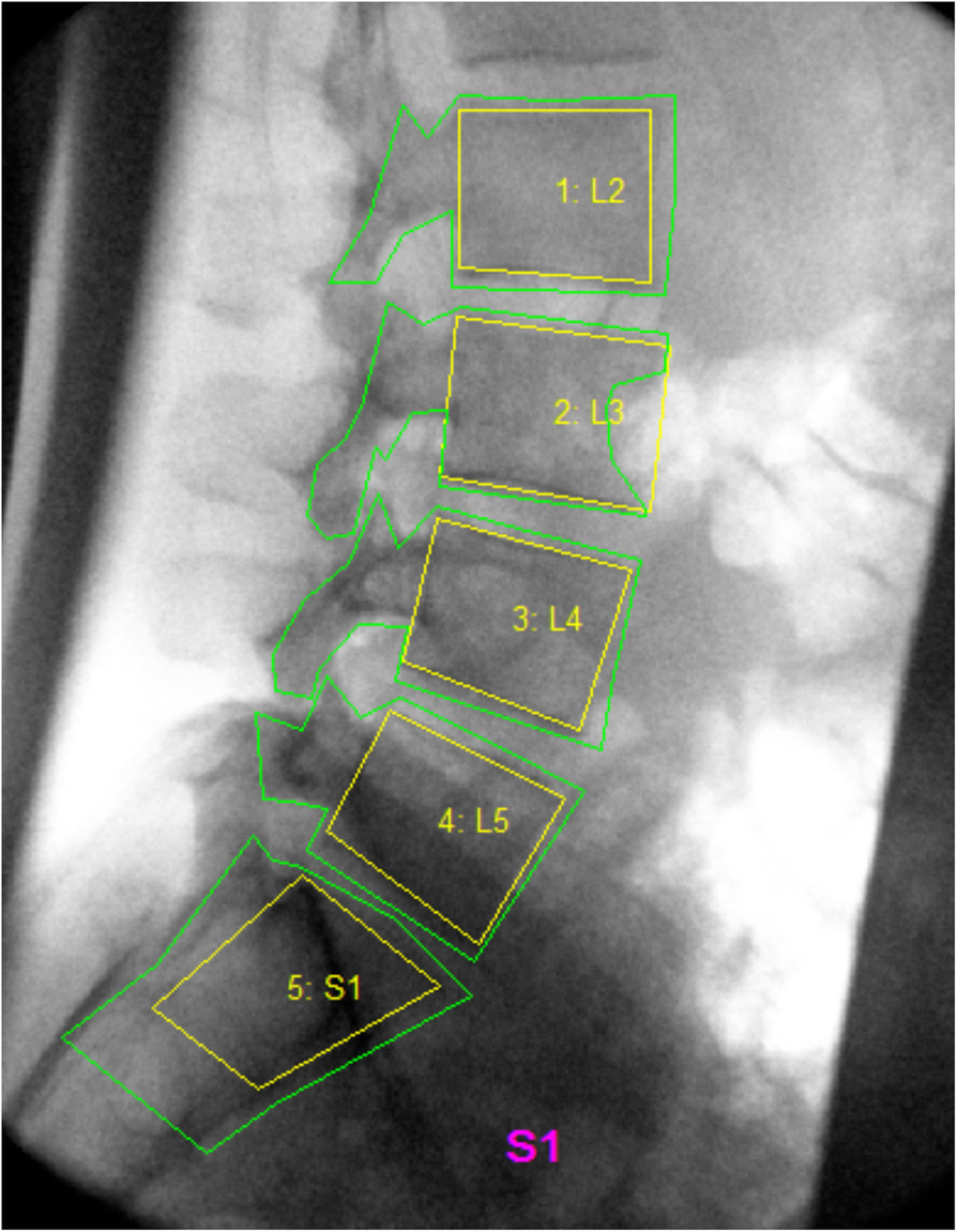 Fig. 2