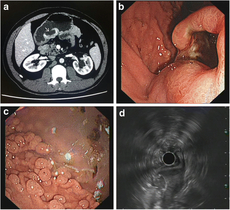 Fig. 1