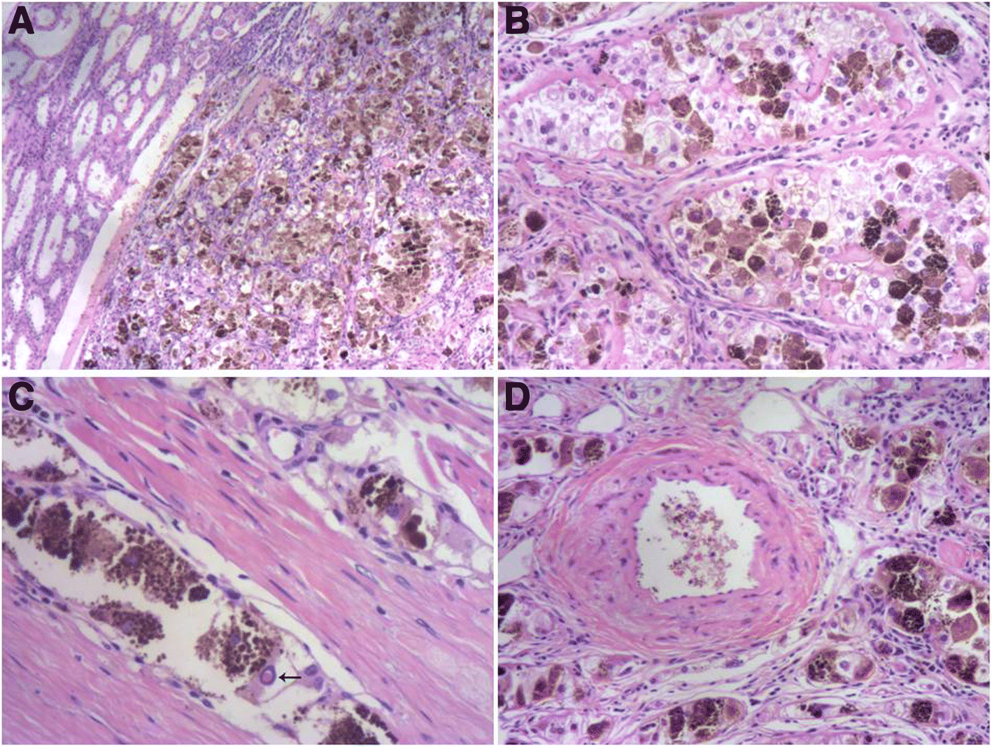 Fig. 2