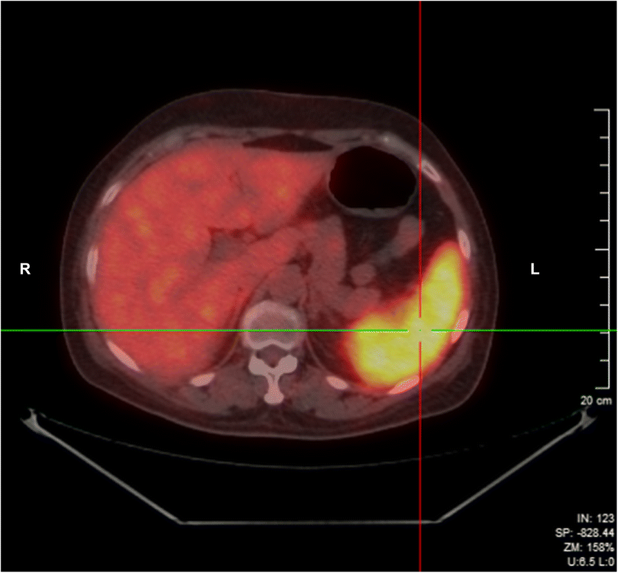 Fig. 1