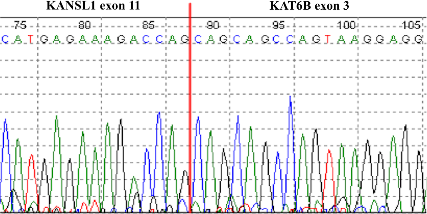 Fig. 3