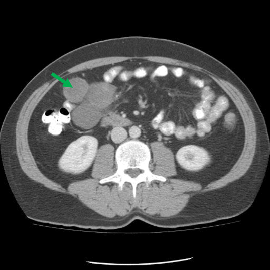 Fig. 1