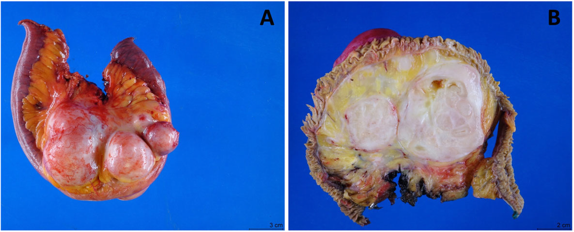 Fig. 2