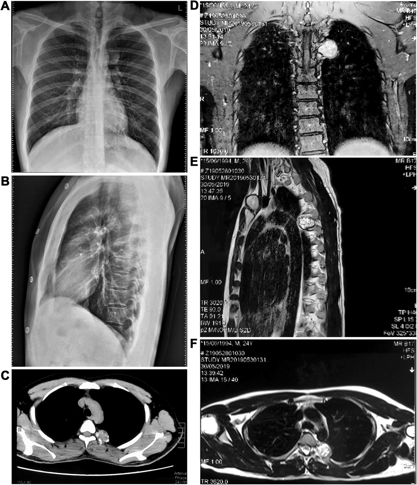 Fig. 1